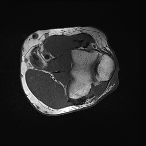 Click on the Serie image to view the images of Wieszt, Gnter